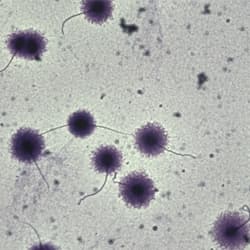 DNA fragmentation — Classification and export