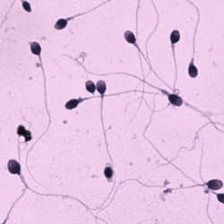 Morphology — Spermiogram