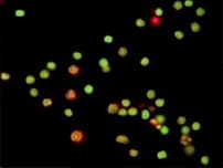 Application example — Endocell